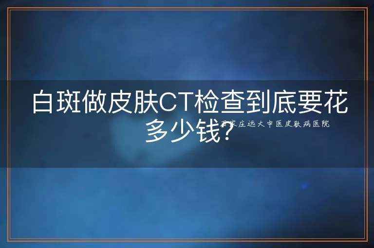 白斑做皮肤CT检查到底要花多少钱？