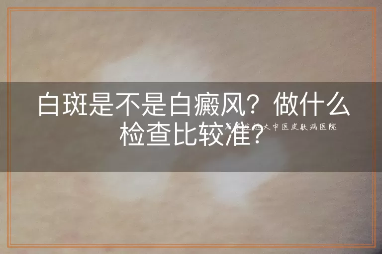 白斑是不是白癜风？做什么检查比较准？