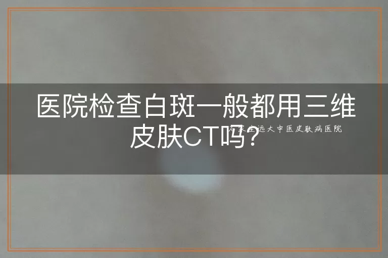 医院检查白斑一般都用三维皮肤CT吗？