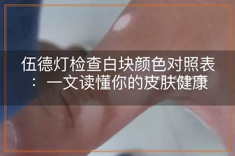 伍德灯检查白块颜色对照表：一文读懂你的皮肤健康