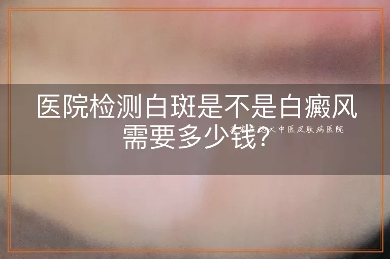 医院检测白斑是不是白癜风需要多少钱？