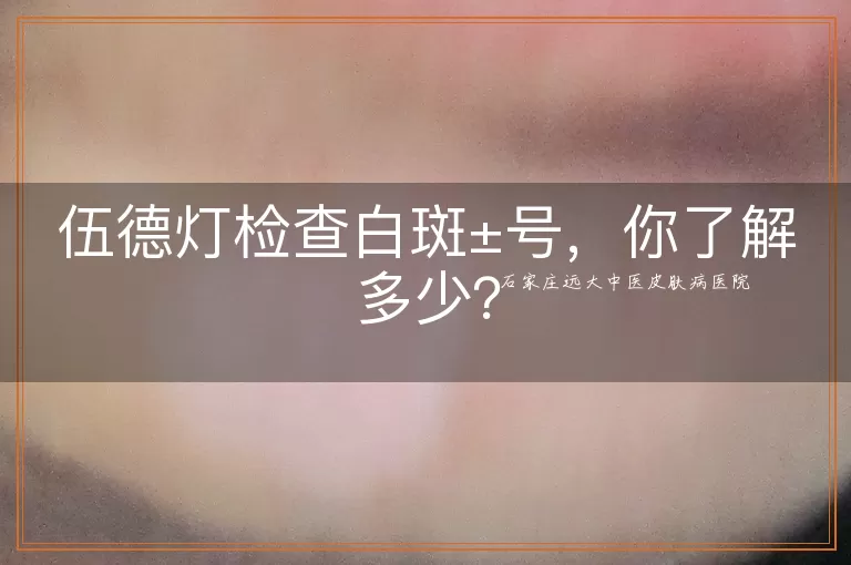 伍德灯检查白斑±号，你了解多少？