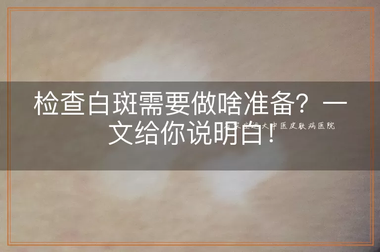 检查白斑需要做啥准备？一文给你说明白！