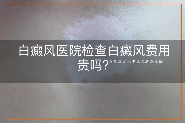 白癜风医院检查白癜风费用贵吗？