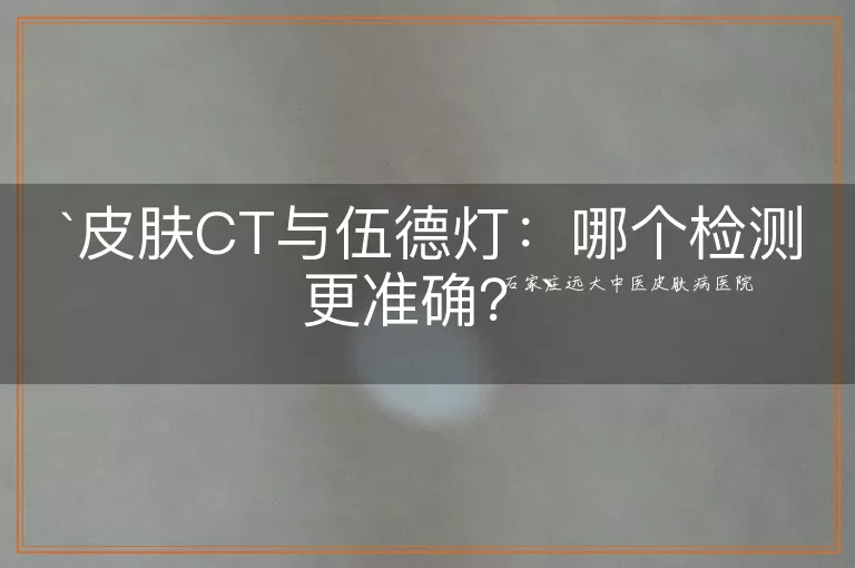 皮肤CT与伍德灯：哪个检测更准确？