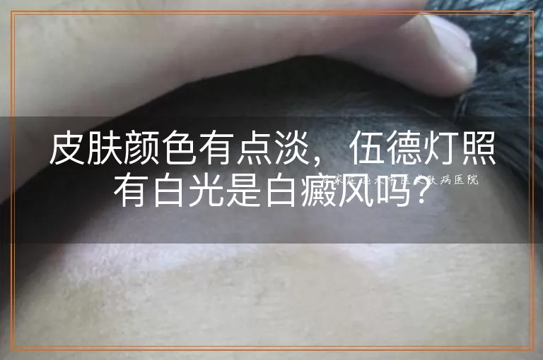 皮肤颜色有点淡，伍德灯照有白光是白癜风吗？