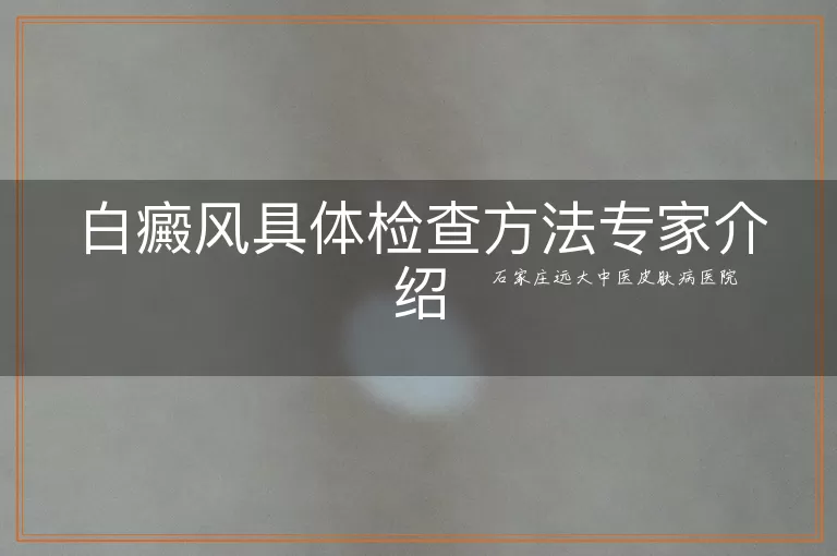 白癜风具体检查方法专家介绍