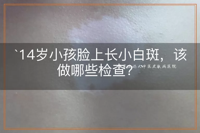 14岁小孩脸上长小白斑，该做哪些检查？