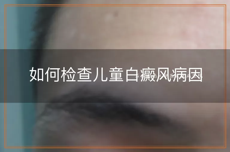 如何检查儿童白癜风病因