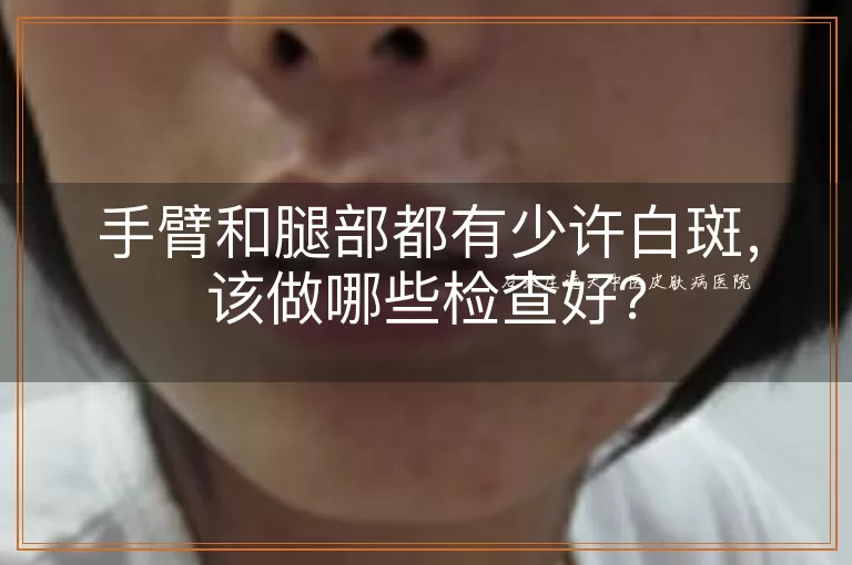 手臂和腿部都有少许白斑，该做哪些检查好？