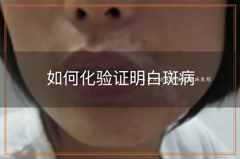 如何化验证明白斑病