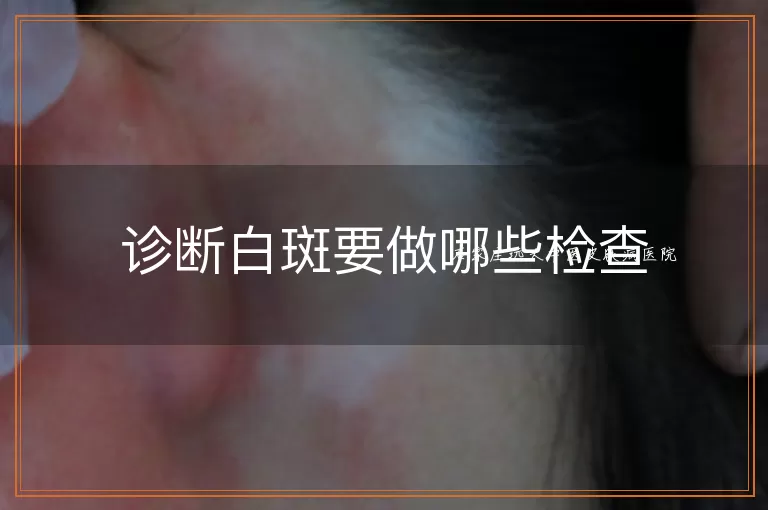 诊断白斑要做哪些检查
