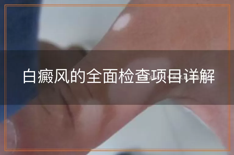白癜风的全面检查项目详解