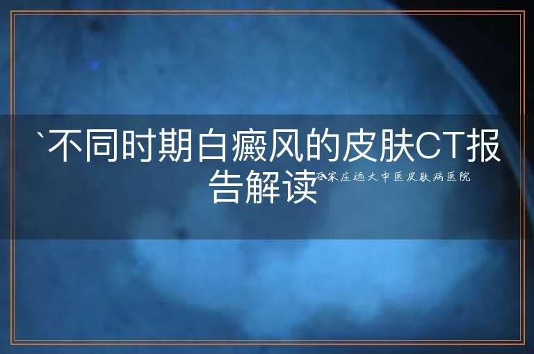 不同时期白癜风的皮肤CT报告解读