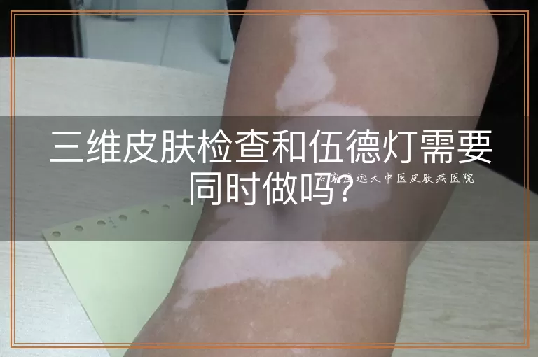 三维皮肤检查和伍德灯需要同时做吗？