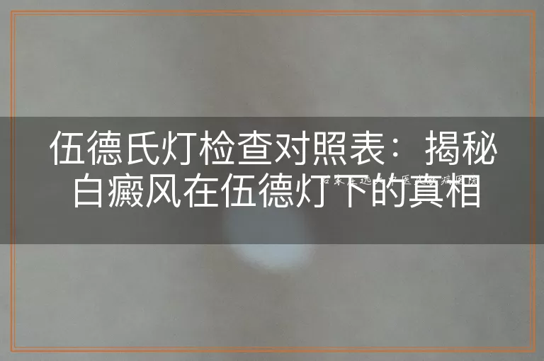 伍德氏灯检查对照表：揭秘白癜风在伍德灯下的真相