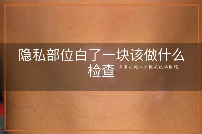 隐私部位白了一块该做什么检查