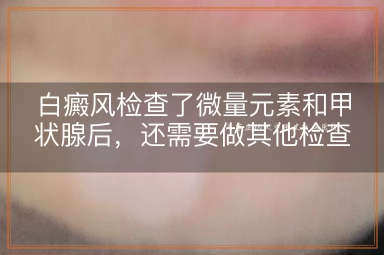 白癜风检查了微量元素和甲状腺后，还需要做其他检查吗？