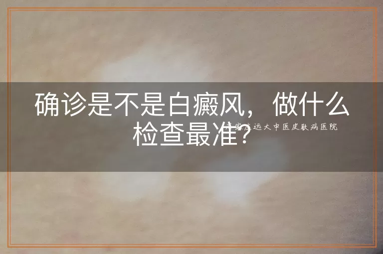确诊是不是白癜风，做什么检查最准？