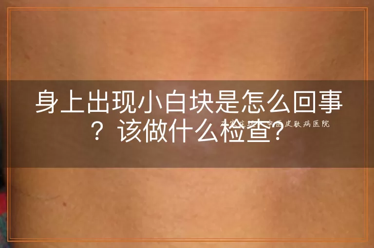身上出现小白块是怎么回事?该做什么检查?