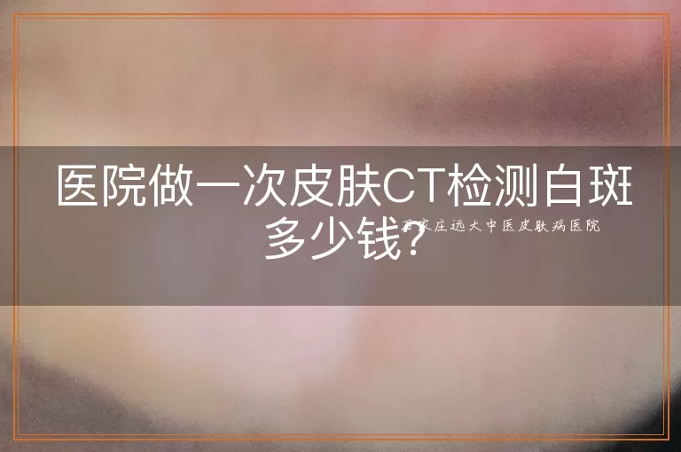 医院做一次皮肤CT检测白斑多少钱？