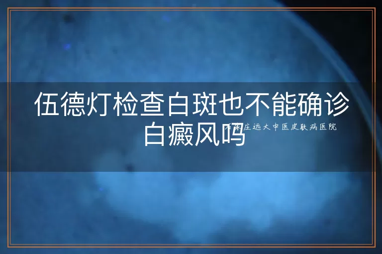 伍德灯检查白斑也不能确诊白癜风吗