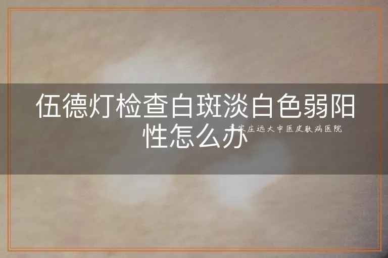 伍德灯检查白斑淡白色弱阳性怎么办