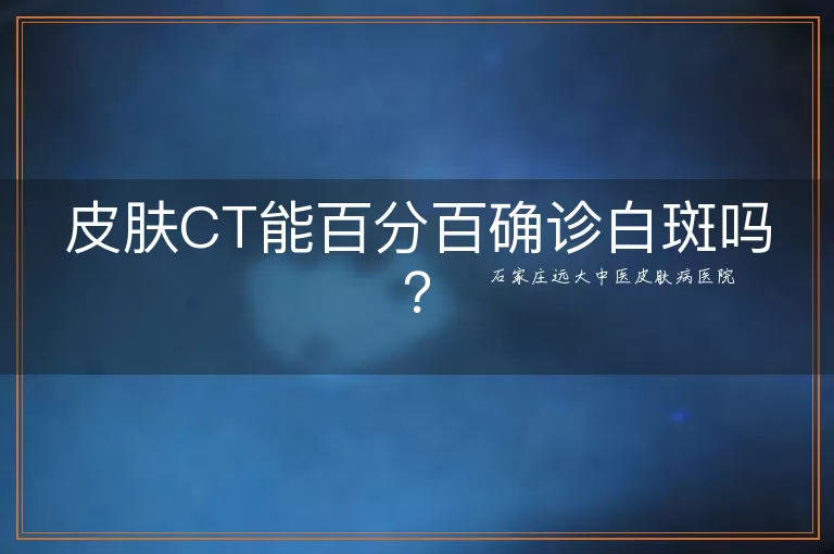 皮肤CT能百分百确诊白斑吗？
