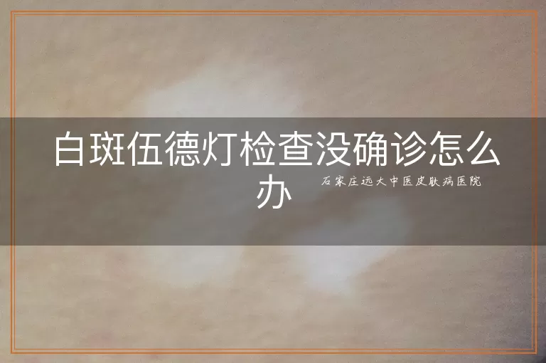 白斑伍德灯检查没确诊怎么办