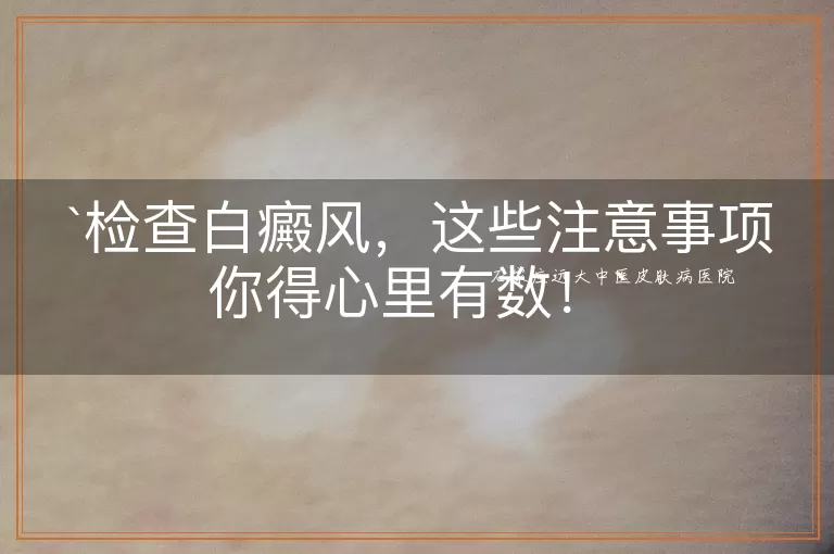 检查白癜风，这些注意事项你得心里有数！