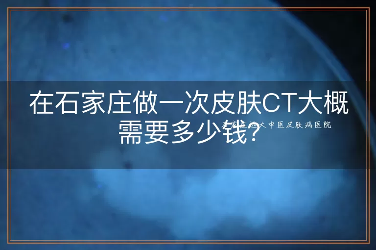 在石家庄做一次皮肤CT大概需要多少钱?