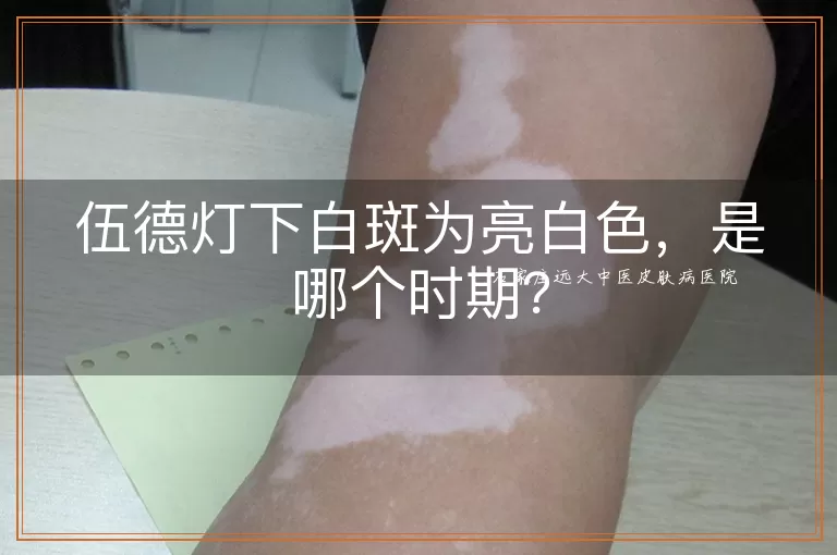 伍德灯下白斑为亮白色，是哪个时期？