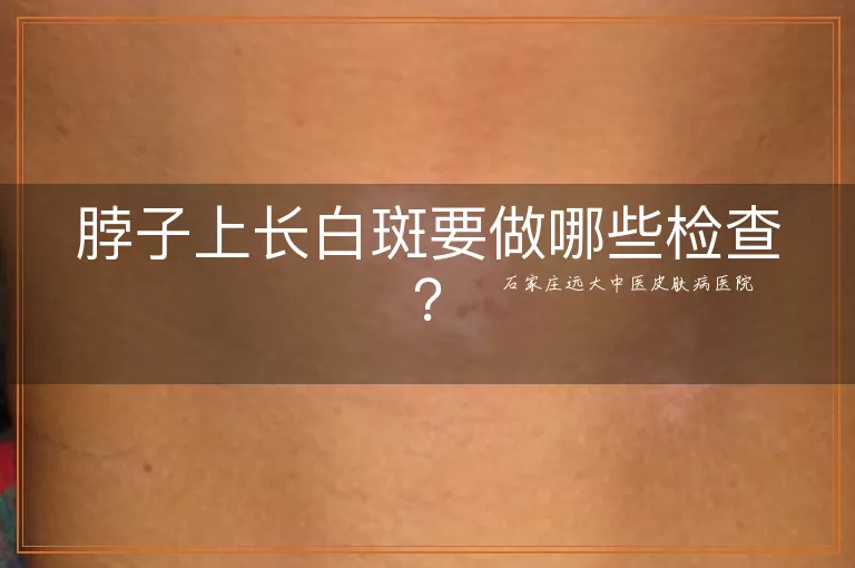 脖子上长白斑要做哪些检查？