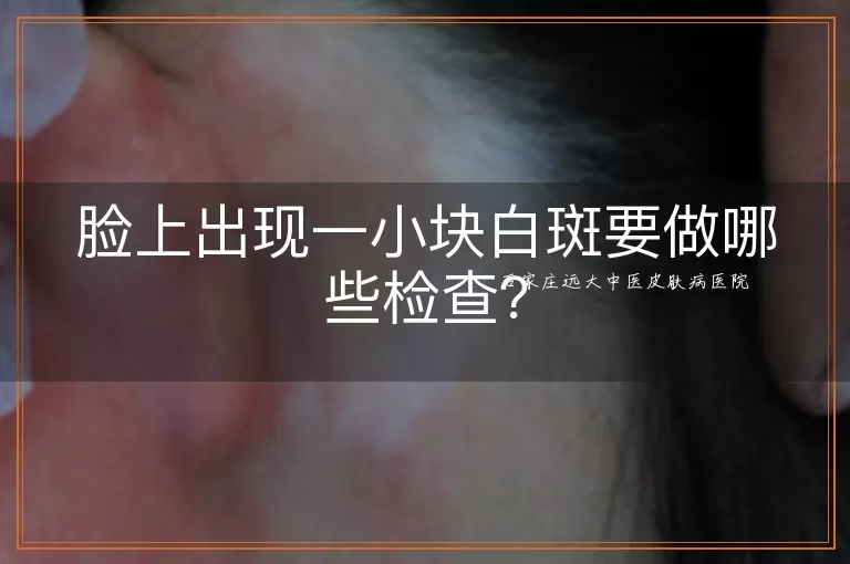 脸上出现一小块白斑要做哪些检查？