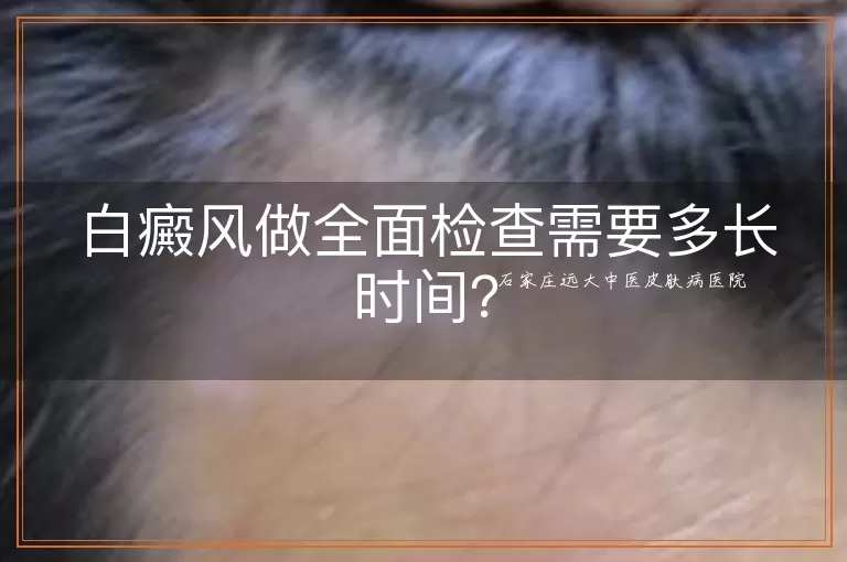 白癜风做全面检查需要多长时间？