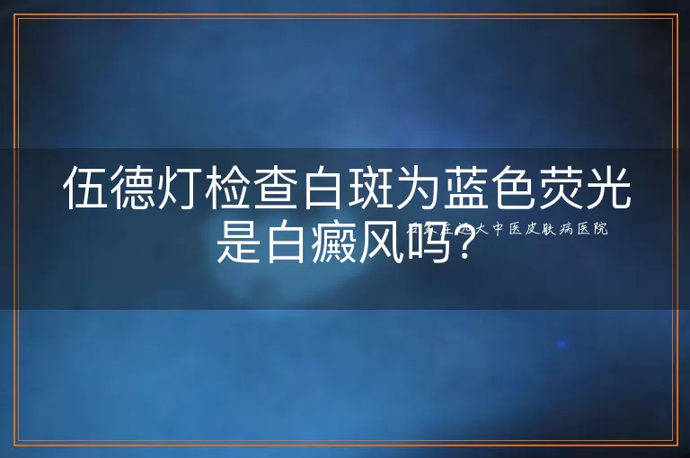 伍德灯检查白斑为蓝色荧光是白癜风吗？