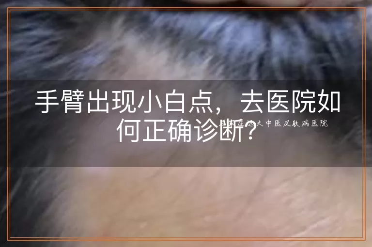 手臂出现小白点，去医院如何正确诊断？
