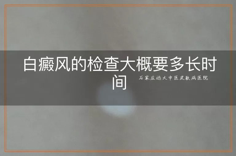 白癜风的检查大概要多长时间