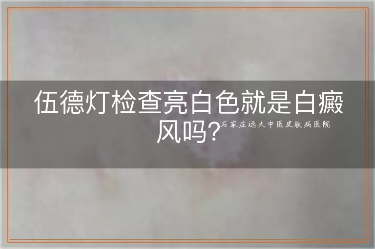 伍德灯检查亮白色就是白癜风吗？