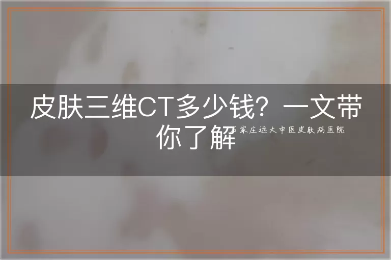 皮肤三维CT多少钱？一文带你了解
