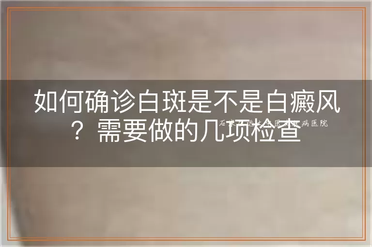 如何确诊白斑是不是白癜风？需要做的几项检查