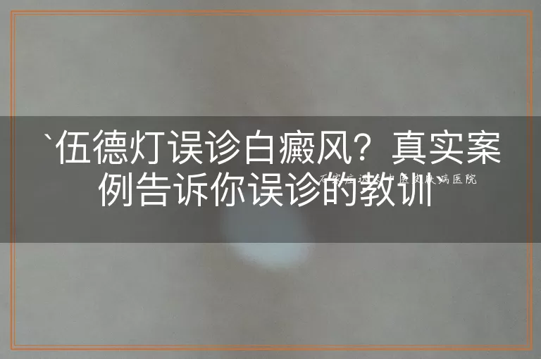 伍德灯误诊白癜风？真实案例告诉你误诊的教训