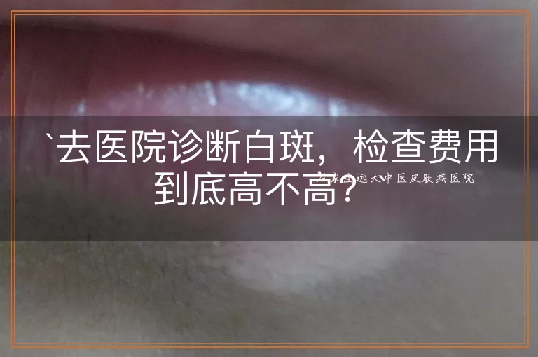 去医院诊断白斑，检查费用到底高不高？