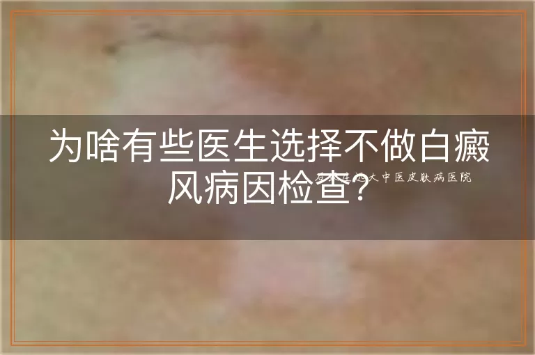 为啥有些医生选择不做白癜风病因检查？