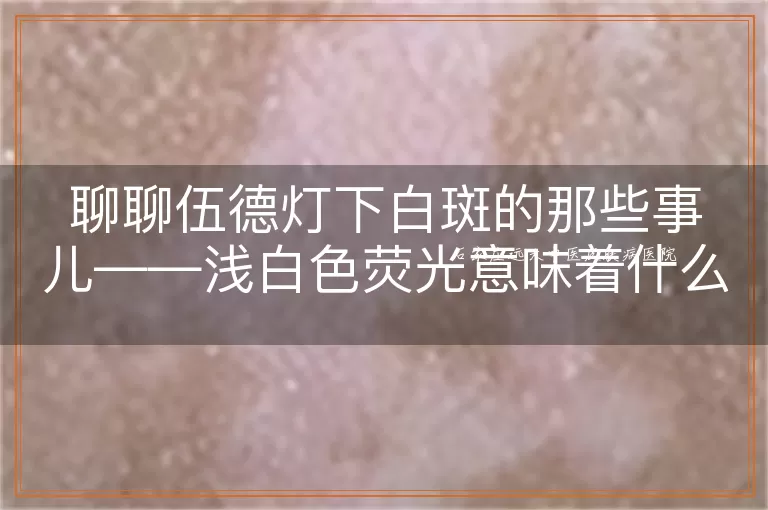 聊聊伍德灯下白斑的那些事儿——浅白色荧光意味着什么？