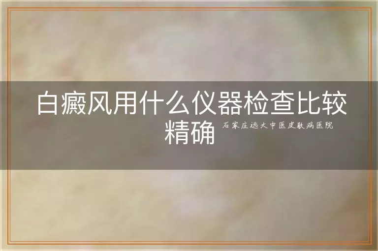 白癜风用什么仪器检查比较精确