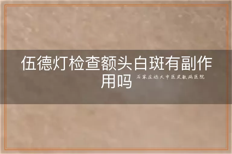 伍德灯检查额头白斑有副作用吗