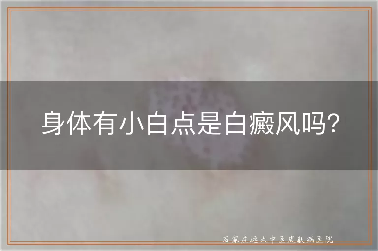 身体有小白点是白癜风吗？
