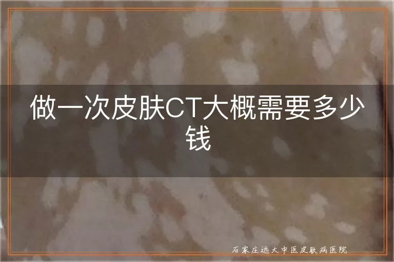做一次皮肤CT大概需要多少钱