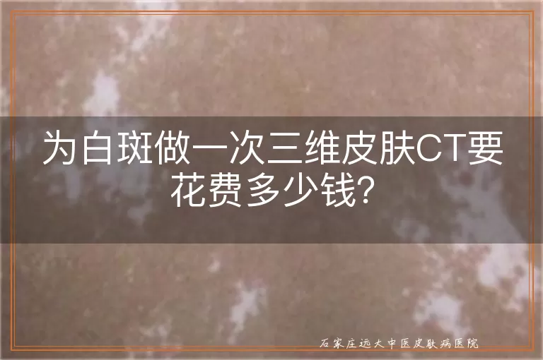 为白斑做一次三维皮肤CT要花费多少钱？